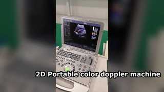 US15 Plus 2D Draagbare kleurendopplermachine
