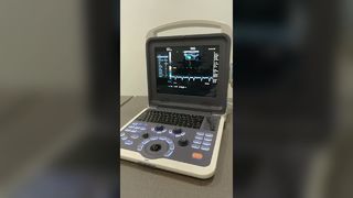 BR-US22 Echografieapparaat