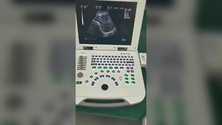 Volledig digitaal laptop-echografie-diagnostisch systeem 80element BR-US11