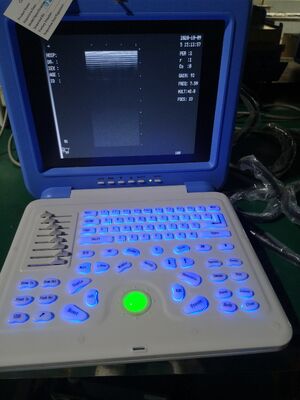 Digital Laptop Ultrasonic  Diagnosis  Equipment to Human