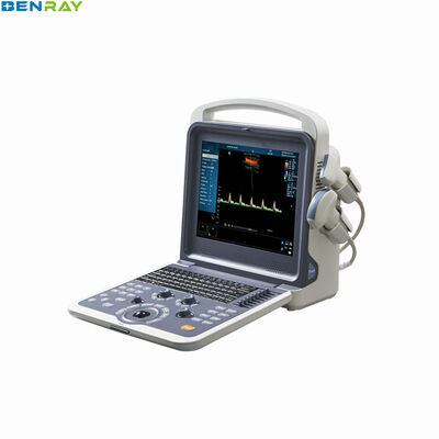 Draagbaar kleurendoppler ultrasoon diagnostisch systeem 80 elementen